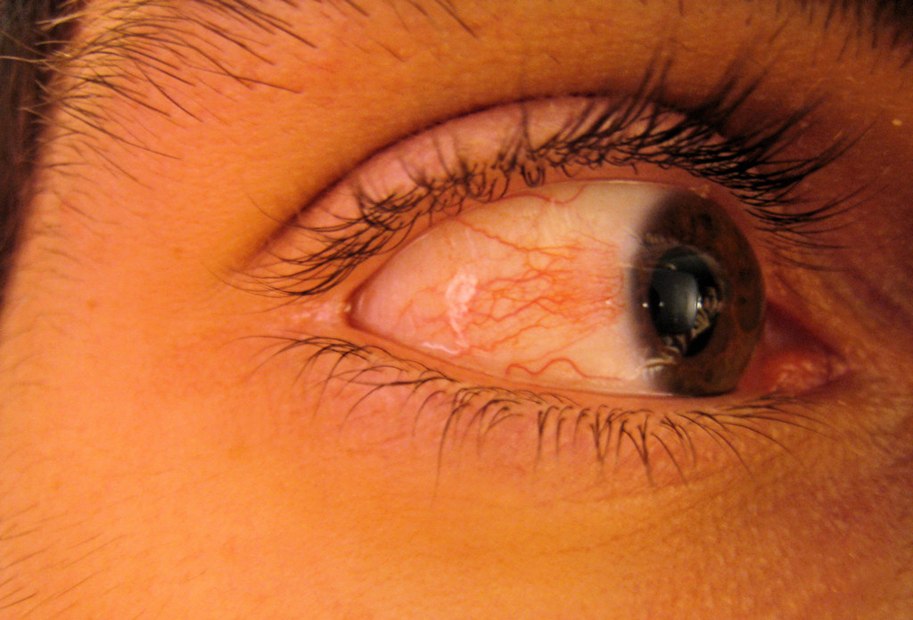 Mijn rode oog... WTF | WTF, wat is hier in godsnaam gebeurd? Waarom is... Flickr