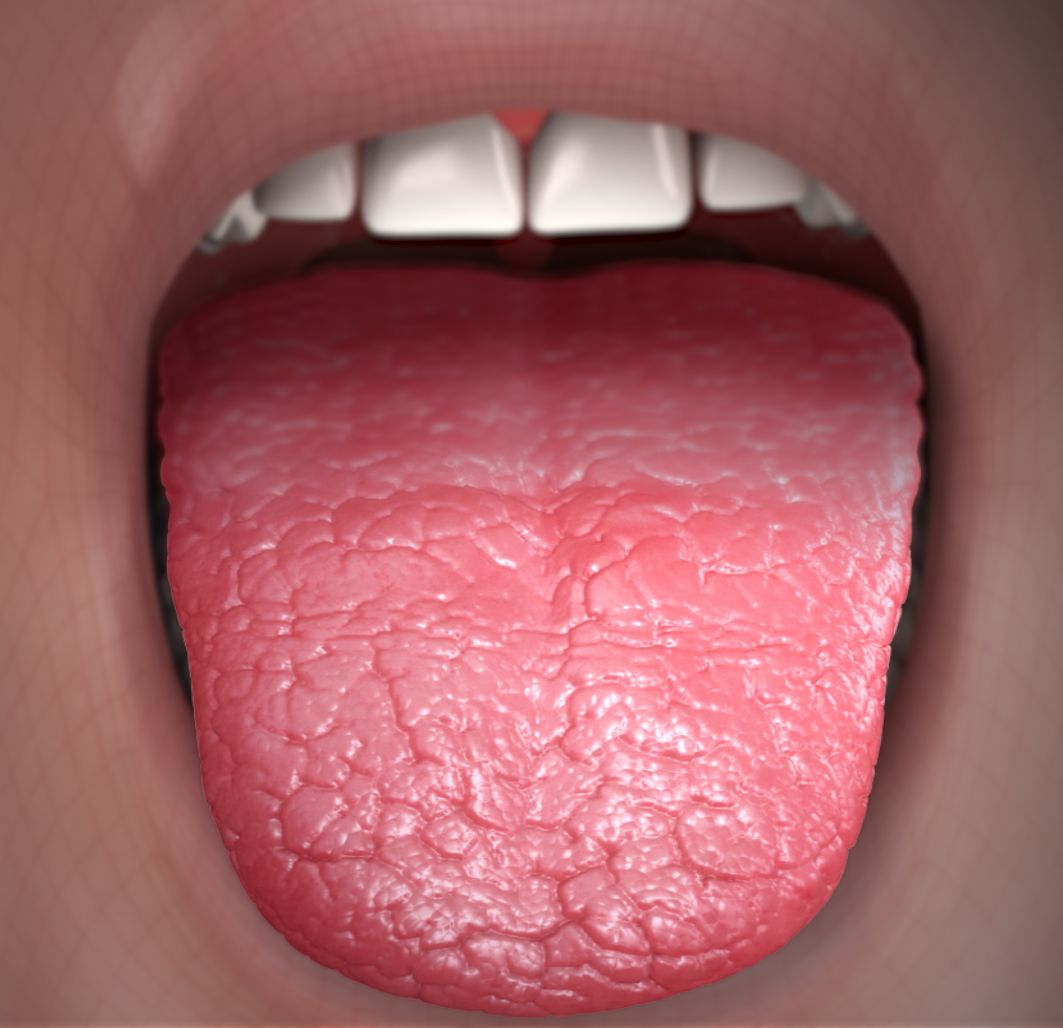 behandeling van een droge mond