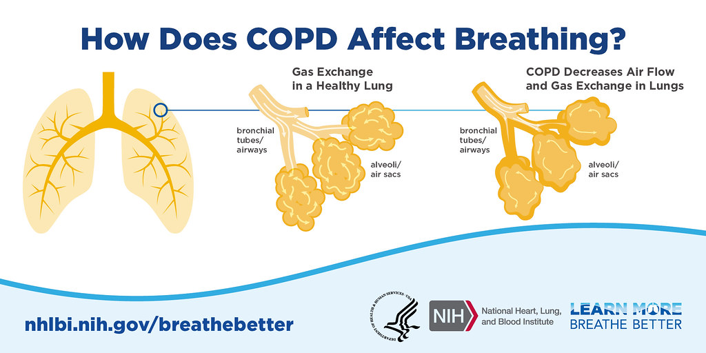 COPD-Behandlung