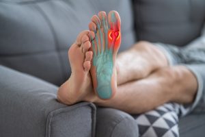 gout home remedies