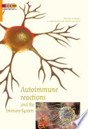 Reaksi autoimun dan sistem kekebalan tubuh