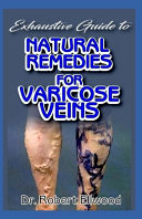 Exhaustive Guide to Natural Remedies for Varicose Veins
