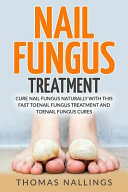 Nail Fungus Treatment
